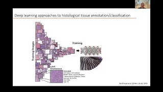 Artificial Intelligence in Pathology: Implementation Strategies - Dr. Phedias Diamandis