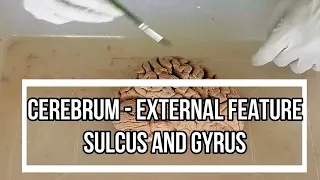 Cerebrum - External Feature / cerebrum sulci and gyri anatomy