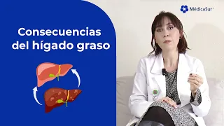 Consecuencias de tener hígado graso