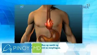 Pinoy MD: Normal ba ang pananakit ng puso kapag may acid reflux?