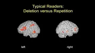 Brain Imaging Studies of Reading and Reading Disability