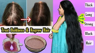 Remedy Of Baldness & Hair Thinning,Regrow lost Hair गंजेपन की दवा जो बालों को झड़ने से रोके।