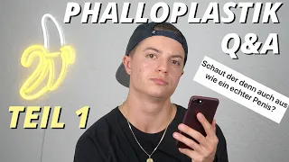 Phalloplastik Q&A Teil 1 - ftm transgender - Penisaufbau