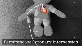 Playdough Surgery 🎈🫀- Percutaneous Coronary Intervention (Coronary Angioplasty w Stent Placement)