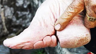 The Horrors Behind Foot Binding