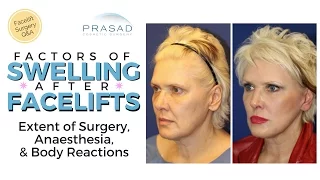 Contributing Factors of Extended Swelling after a Facelift