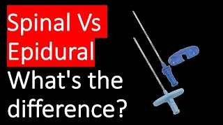 Whats the difference between spinal and epidural anaesthesia