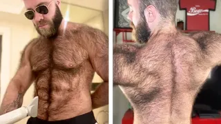 Hairy Man Says He's Compared To Real Life Werewolf