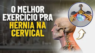 O MELHOR EXERCICIO PRA HÉRNIA DE DISCO NA CERVICAL - Fisioprev com Guilherme Stellbrink