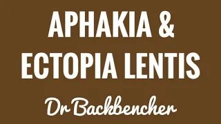 Aphakia and Ectopia Lentis - Etiology, symptoms and management - Ophthalmology Lectures