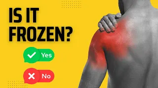 Frozen Shoulder Assessment Video