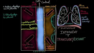 Epanchement pleural - Docteur Synapse