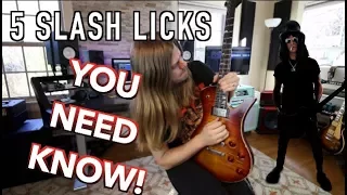 5 Slash Licks You Need To KNOW!! ( With Tabs)