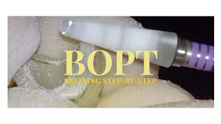 BOPT Provisional step-by-step