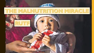 RUTF (READY TO EAT THERAPEUTIC FOOD) - TO COMBAT SEVERE ACUTE MALNUTRITION.