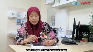 Laser Vision Correction by Dr Umi