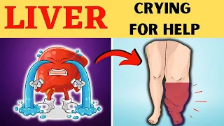 10 Signs Your Liver is Crying for Help