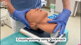 Cricothyrotomy using Quicktrach