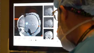 Robot-Assisted Laser Ablation Surgery