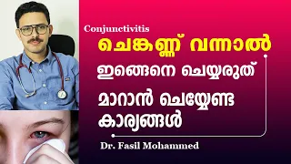 ചെങ്കണ്ണ് എളുപ്പത്തിൽ  മാറാൻ | Chenkannu treatment in malayalam | Conjunctivitis malayalam