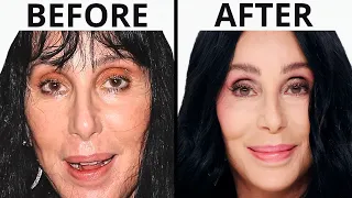 Cher's NEW FACE | Plastic Surgery Analysis