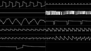 VinylCheese - "The Street Loader" (FC + N163) [Oscilloscope View]