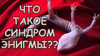 ЧТО ТАКОЕ СИНДРОМ ЭНИГМЫ И КАК ЕГО ЛЕЧИТЬ??