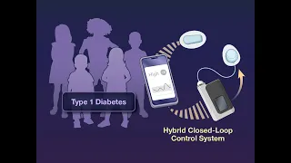 Hybrid Closed-Loop Control in Young Children with Type 1 Diabetes | NEJM