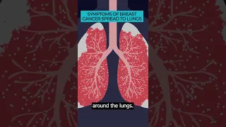 Recognizing Symptoms of Breast Cancer Spread to Lungs 🩺🎗️💨