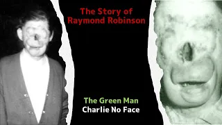 The Tragic Story Behind The Green Man, Charlie No Face | Raymond Robinson