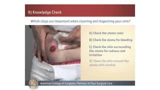 Colostomy/Ileostomy: Knowledge Check