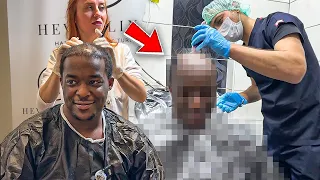 I Went To Turkey For A Hair Transplant 😨 .