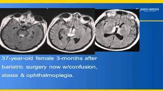 e-Radiology Learning | Neuroradiology Pearls and Pitfalls (1 of 4)