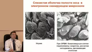 Риносинусит от стандартов к клинической практике