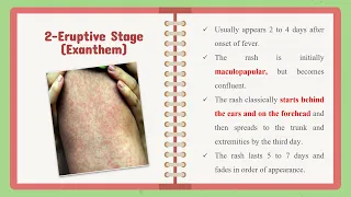 Infection, Fever with rash (part 1), Dr. Sarah El Shall