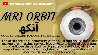 How to Have MRI (Orbit) Eye