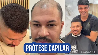 PRÓTESE CAPILAR COM CABELO AFRO