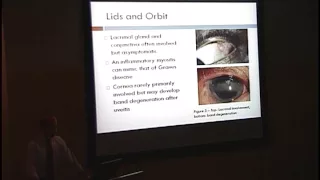 Ocular Manifestations of Sarcoidosis