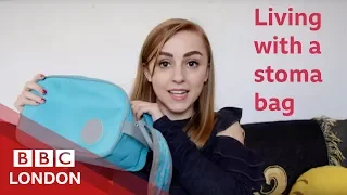 Living with a stoma bag (feat Hanna Witton) - BBC London