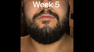 20 year old beard growth 5 weeks