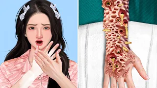 ASMR Remove Multiple Eyes & Worm Infected Hand