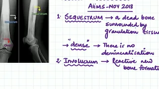 sequestrum, involucrum and cloacae