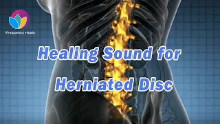 Sound Treatment for Herniated Disc | Reduce Pain & Relieve Numbness of Your Body