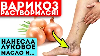 Стирает вены и узлы как ластик! Боль в ногах прошла после простого, копеечного рецепта…