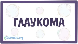 Глаукома — причины, симптомы, патогенез, диагностика, лечение