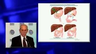 Dr. Bennett Roth on Digestive and Nutritional Issues Following Surgery for Pancreatic Cancer