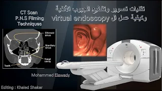 تقنيات تصوير وتقطيع الجيوب الانفية وكيفية عمل منظار بالاشعة المقطعية | CT Scan P.N.S Imaging
