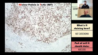 Immunohistochemistry in Pathology