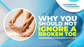 Why You Should Not Ignore a Broken Toe