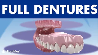 Removable FULL DENTURE - How to clean and care for complete dentures ©